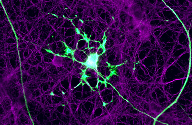A myelinating oligodendrocyte cell highlighted in green against a purple background